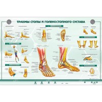 Интерактивный светодинамический стенд "Травмы стопы и голеностопного сустава"