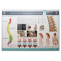 Интерактивный электрифицированный стенд "Патологии позвоночного столба" с натурными образцами